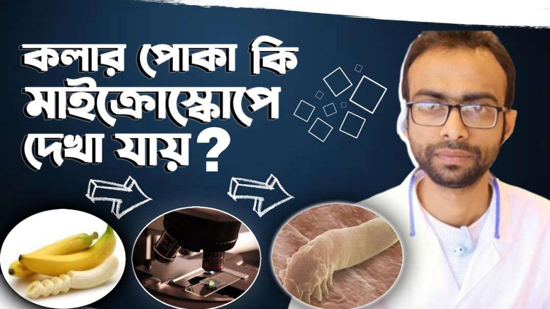 ⁣কলার মধ্যে পোকা! কলাবিজ্ঞান গবেষণা