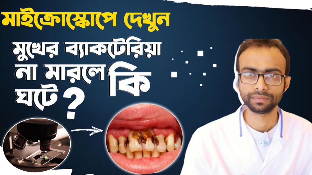 ⁣⁣দাঁত আর ব্যাকটেরিয়ার বিক্রিয়া ক্ষয় হৃদরোগ  গবেষনা