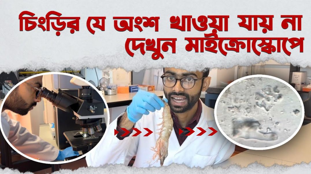 ⁣মাইক্রোস্কোপ এ চিংড়ি- ১০০০ গুন বড় করে