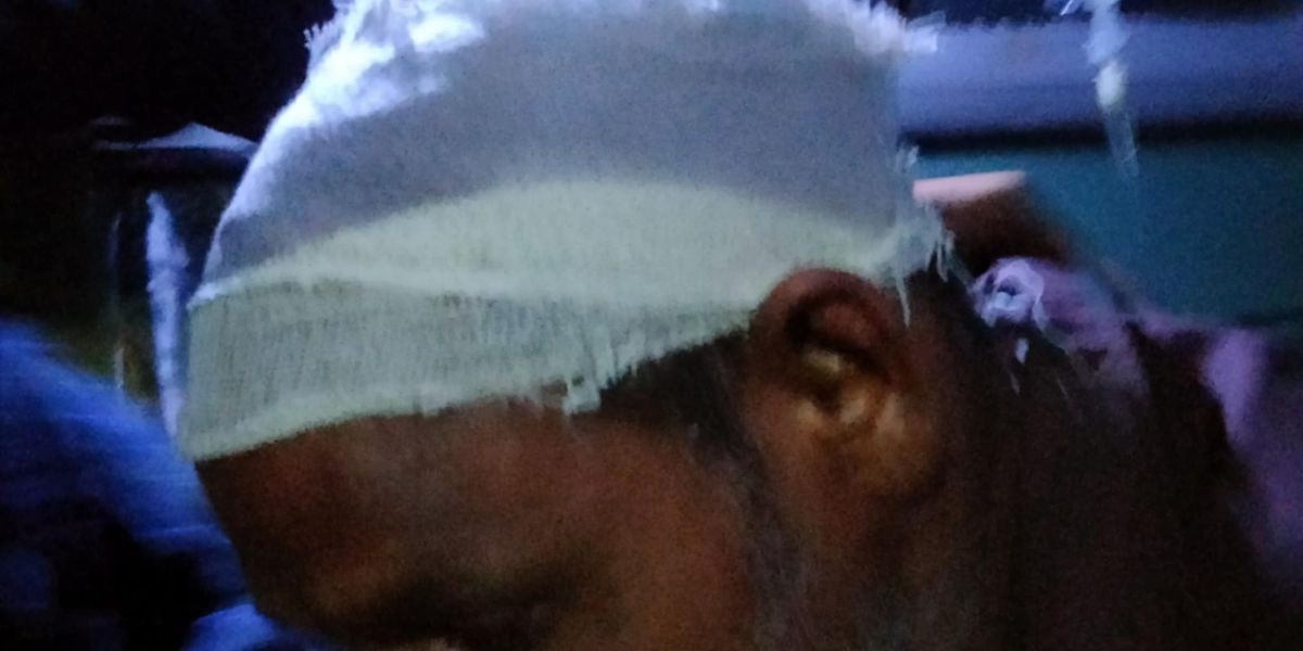 ফসলি জমিতে যাওয়ার পথে প্রতিবন্ধকতা, হামলায় আহত দম্পতি