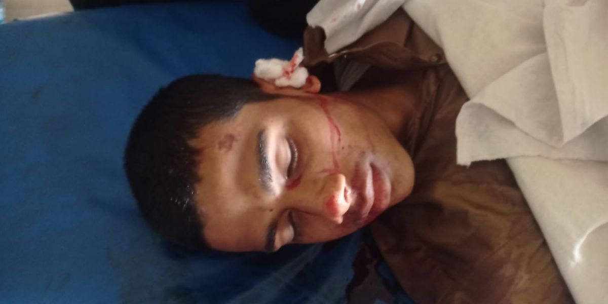 কিশোরগঞ্জের পাকুন্দিয়ায় বাসচাপায় সিএনজি আরোহী নিহত