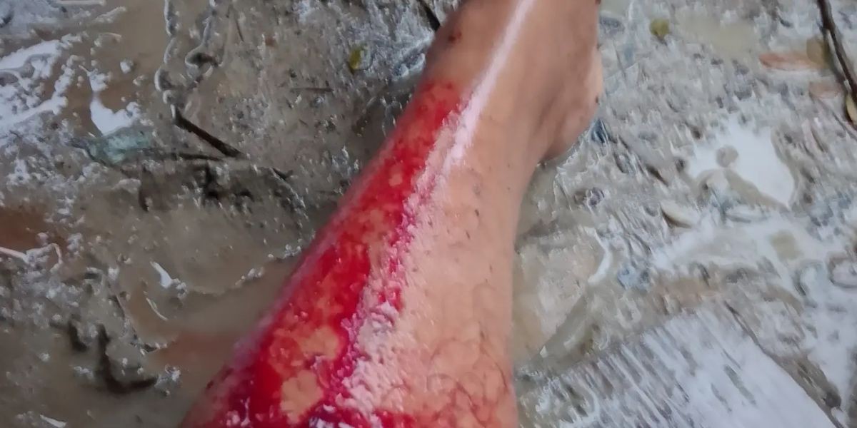 চাঁদা না পেয়ে ভাবিকে ধর্ষণচেষ্টা  ও কুপিয়ে হত্যাচেষ্টা গুরতর জখম তিনজন ।..