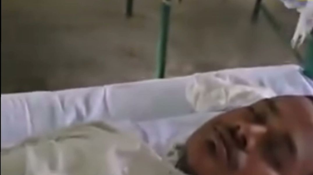 লাইভ করতে যেয়ে যুবককে সাপের দংশন