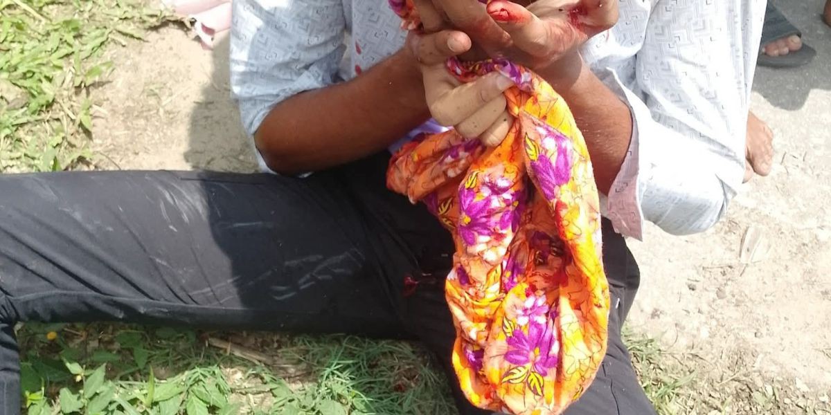 রানীশংকৈলে সড়ক দুর্ঘটনায়  নিহত ১ আহত ২