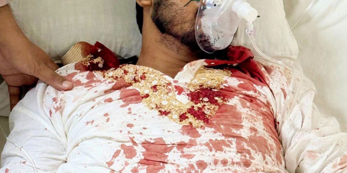 কাকরাইলে সহিংসতায় গুরুতর আহত নুরুল হক নূর, গণঅধিকার পরিষদের নেতাকর্মীদের আহাজারি..