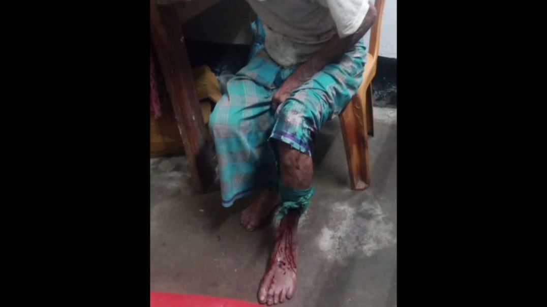 ⁣ভান্ডারিয়ার ভেদুরিয়া স্টিল ব্রিজের জরাজীর্ণ অবস্থা: মারাত্মক ভাবে জখম এক।