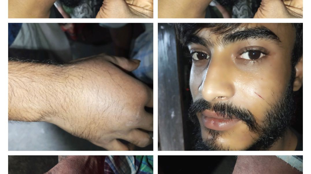 সোহান নামের এক ব্যক্তি অটোরিকশা চুরি করতে গিয়ে জনতার হাতে ধরা পড়ে