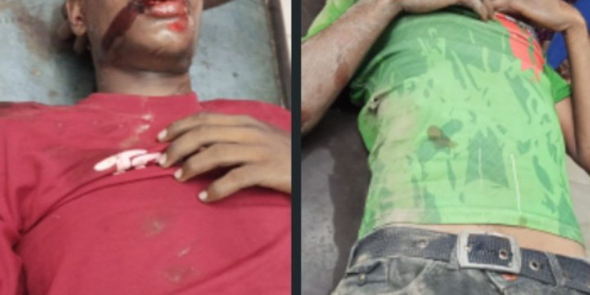 যশোর চৌগাছায় মোটরসাইকেল ও সিএনজি দুর্ঘটনায় আহত (২)