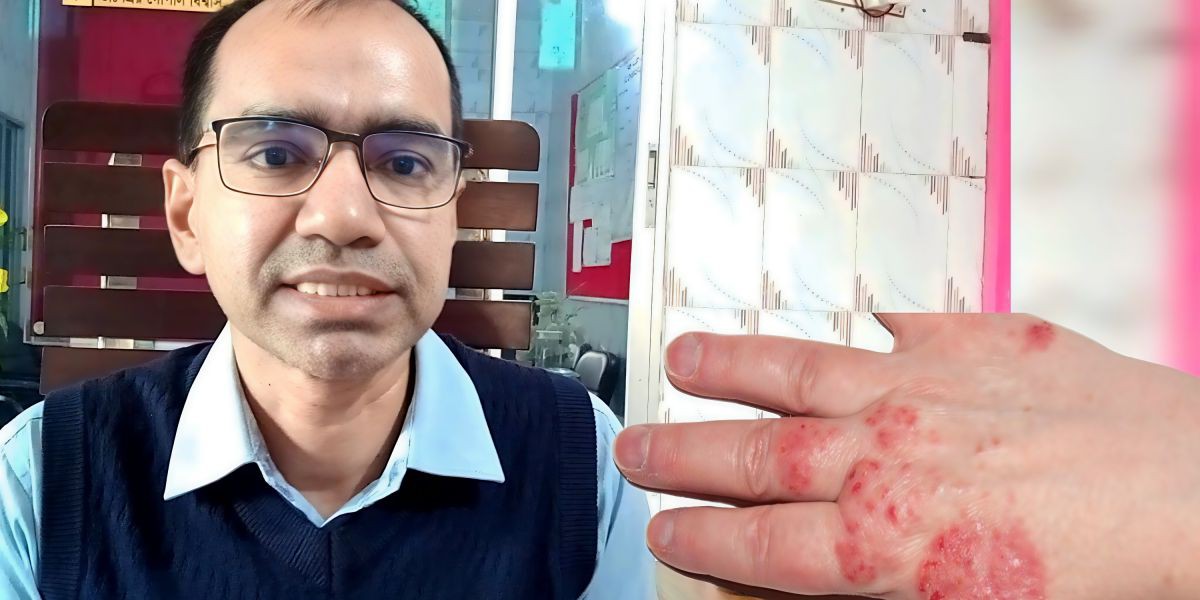 শরণখোলায় ছোঁয়াচে চর্ম রোগের মহামারী