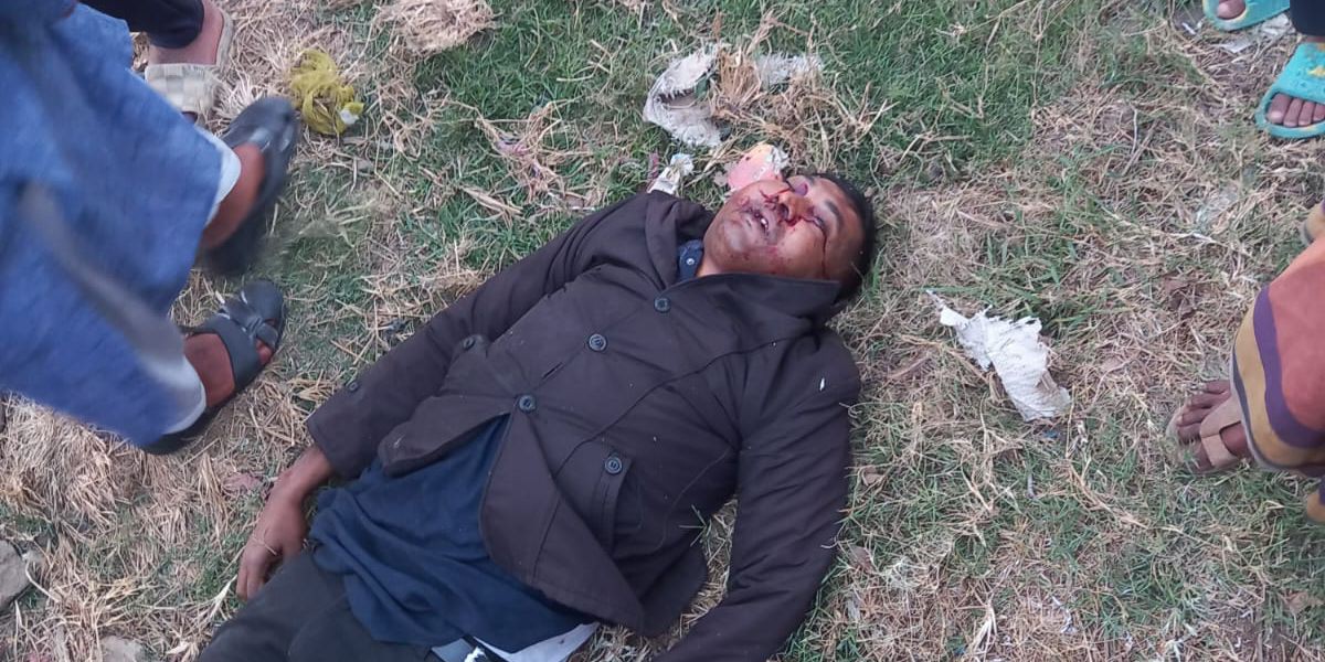 যশোরে দুই মোটরসাইকেলের মুখোমুখি সংঘর্ষে সেনাসদস্য নিহত, আহত ৩..