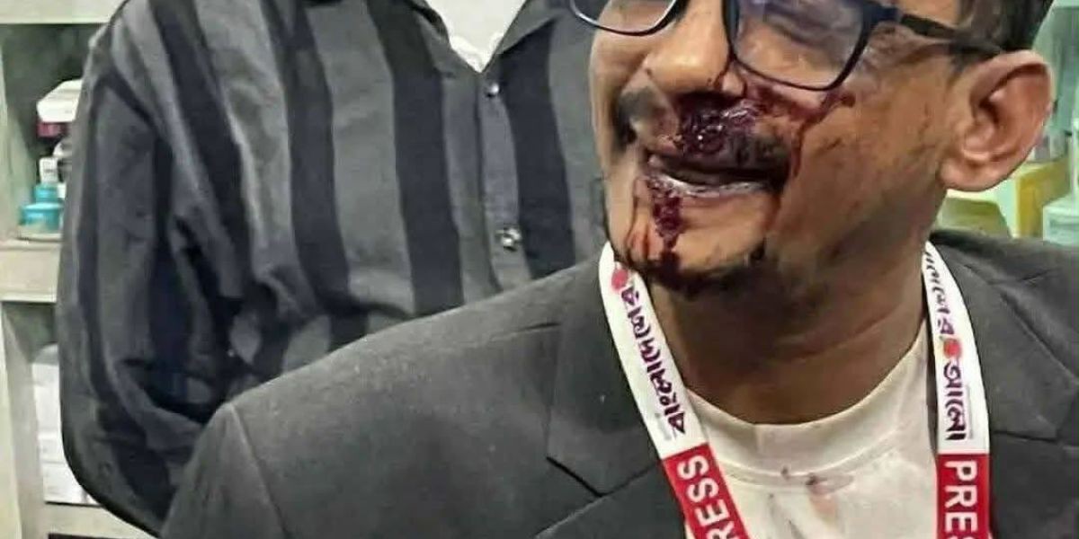 রাতের আঁধারে ব্যালটে সিল মারার দৃশ্য ধারণ করায় সাংবাদিক টিটুকে রক্তাক্ত করেছে জামাত স*ন্ত্রাসীরা..