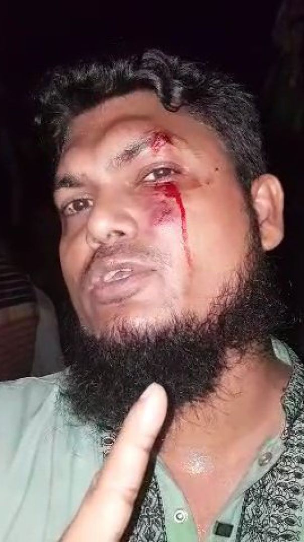 দৈনিক নিরপেক্ষ পত্রিকার ভয়েজ আর্টিস্ট আবু জাফরের উপর সন্ত্রাসী হামলা