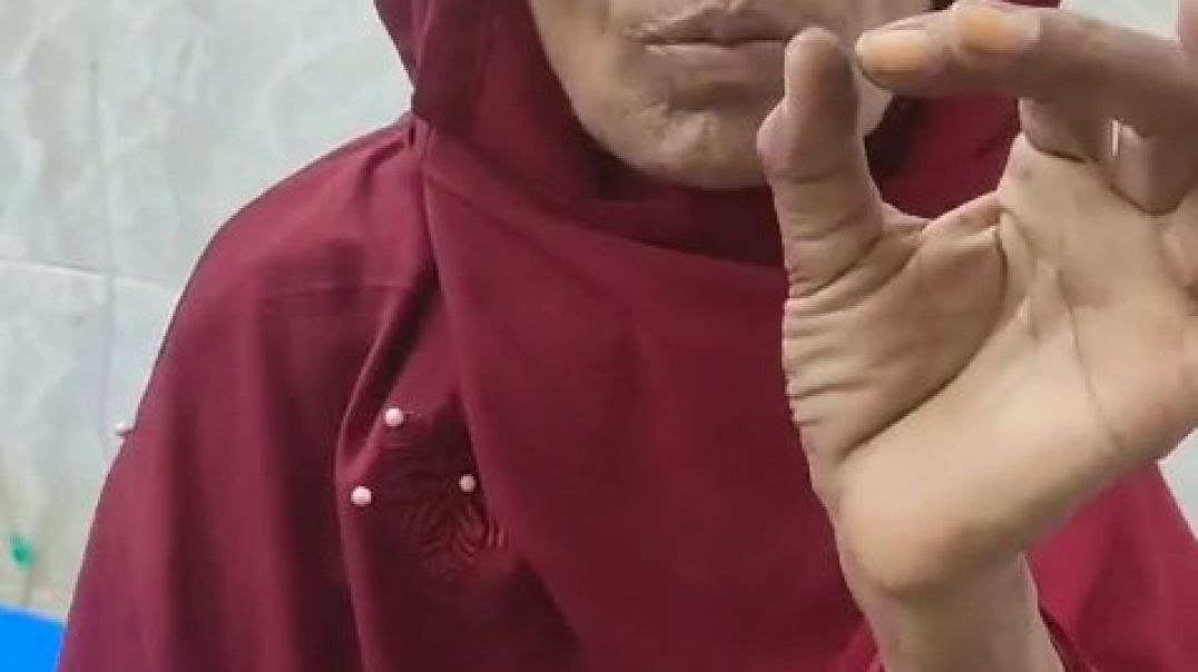 মায়ের হাত ভেঙে দিল ছেলে