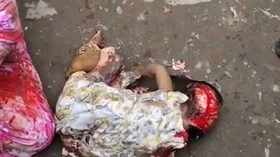 ⁣সাভার বাইপাইলে সড়ক দুর্ঘটনায় ৮ বছরের শিশু নিহত
