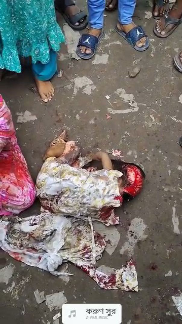 সাভার বাইপাইলে সড়ক দুর্ঘটনায় ৮ বছরের শিশু নিহত